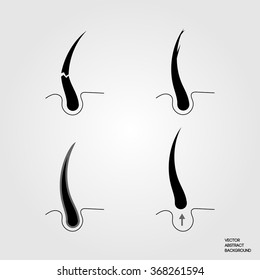 Picture of 4 hair problems: loss, cross-section, brittle, oily hair. Can be used for packaging and advertising hair care products.