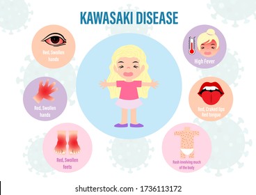 Kawasaki virus Kawasaki Disease: