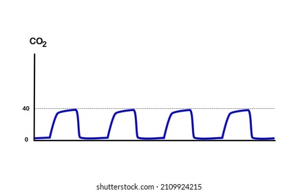 picture of Normal Capnography or end tidal CO2 on white background