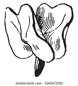 A picture is showing Embryo. This is Embryo of Morning Glorry. It is belongs to Convolvulaceae family. Embryo is part of a seed and the neck like stipule is come out from the embryo, vintage 
