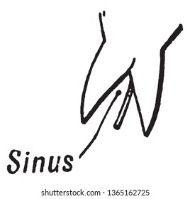 A picture shows the Sinus. It is a space or indentation between two lobes or teeth, usually on a leaf and cleft or recess between two lobes, vintage line drawing or engraving illustration.