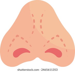 Piggy or Short Over-Rotated Nose concept, Complex Cartilages reconstruction vector flat design, plastic surgeon Symbol, body contouring Sign, Beauty treatment stock illustrati