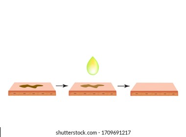 Pigmentación en la piel. manchas marrones en la piel. Tratamiento de pigmentación. Infografía. Ilustración vectorial en fondo aislado.