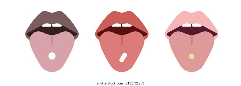 Pillen Sie auf Zungenset. Concept Illustration of the medicinal products. Pharmazeutische, medizinische, gesundheitliche Tablette. Orale Medikation.Vektor