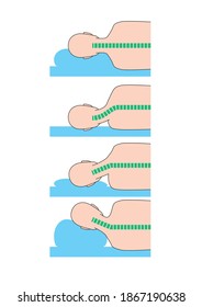 Pillow height and neck strain