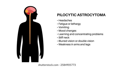 Pilocytic astrocytoma symptoms. Slow growing type of primary central nervous system tumor. Cerebellum disease. Neoplasm in the child silhouette. Problems with balance, coordination, and optic nerve