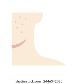 Pimple facial problem closeup. Cheek with acne icon. Beauty, hygiene, skincare, cleansing, treatment concepts. Flat vector character design illustration isolated on white background. 