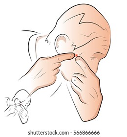 Pimples on the face of a man. A man squeezes a pimple on the face. Rash. Color vector illustration.