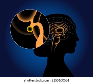 Pineal gland and epithalamus anatomy in the human brain. Endocrine system. Production of melatonin, serotonin derived hormone. Neuroendocrine secretory circumventricular organ 3D vector illustration
