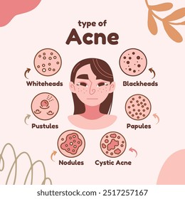 Pink and Brown Illustrated Acne Types Artwork Illustration  