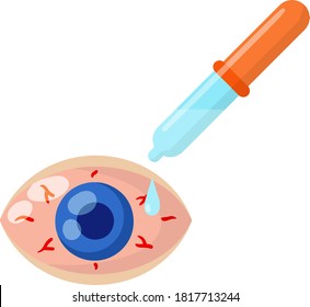 Pipette and eyedropper. Red eye disease. Medicine for blood vessels and Allergy Problems. Conjunctivitis and health. Flat Drop of water. Blue human pupil