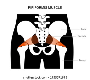 Piriformis muscle concept and structure of human skeleton. Man body anatomical poster with bones of pelvis, legs, spine. Medical flat vector illustration for clinic, hospital or education. X ray image