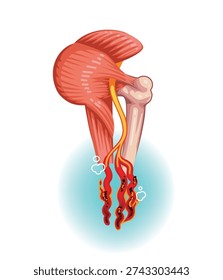 Piriformis Syndrome and Sciatic Nerve Compression Illustration Medical Concept The Connection Between Muscles, Bones, and Nerves; Compression that Causes Dadiating and Burning Pain.