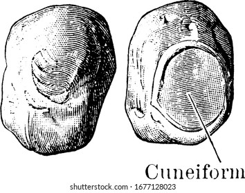 The pisiform bone is one of the small bones that is found in proximal row of the wrist. It lies where ulna bone joins the wrist, vintage line drawing or engraving illustration.