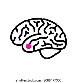 Pituitary adenoma concept. Tumor in the human brain. Disease or cancer in the head. Hypothalamus problem. Posterior and anterior pituitary gland anatomy. Medical flat vector illustration for clinic
