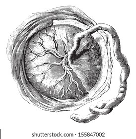 Placenta (internal or fetal face), vintage engraved illustration. Usual Medicine Dictionary by Dr Labarthe - 1885.