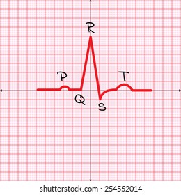 plain Electrocardiography paper in pink background