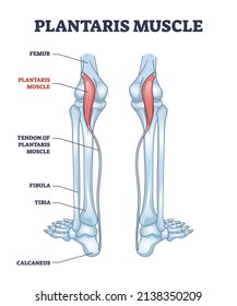 Plantaris muscle as leg superficial posterior compartment part outline diagram. Labeled educational scheme with calcaneus, tendon of plantaris, fibula and tibia skeletal bones vector illustration.