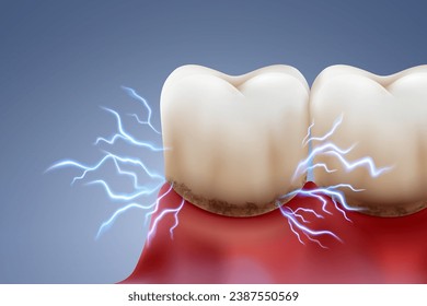 Plaque and tooth sensitivity Electric sparks are like the sharp pain in your teeth caused by plaque and gum inflammation. Dental treatment and protection. Realistic vector illustration file.