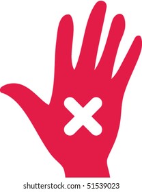 Plaster Hand
