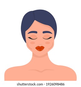 Plastic surgery, beauty injection, change of appearance, line of incisions on the female face. Vector pink illustration.