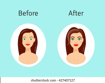 Plastic Surgery Before And After Vector Illustration. Beautiful Girl After Plastic Surgery Procedures In Cartoon Style.