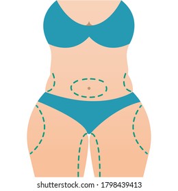 Plastic surgery body icon in flat style Vector illustration of fat female body with surgery markers for operation