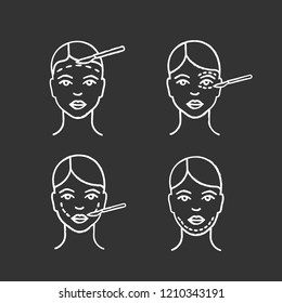 Plastic surgery chalk icons set. Facelift surgery, blepharoplasty, double chin removal, cheek lift surgery. Isolated vector chalkboard illustrations