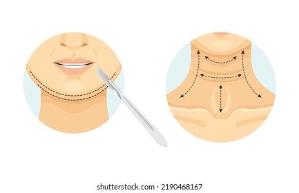 Plastic Surgery For Chin And Neck With Stipple Line As Restoration And Reconstruction Of Human Face In Circle Vector Set