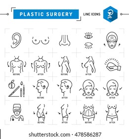 Plastic surgery concept Black thin line icons. Medical symbols and plastic surgery before and after: breast augmentation, liposuction, face and body cosmetology. Vector illustration - Shutterstock ID 478586287