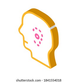 cirugía plástica, pérdida de oreja vector de ícono isométrico. cirugía plástica, signo de pérdida de oído. ilustración de símbolo aislado