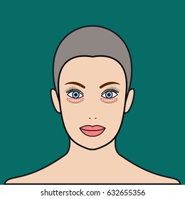 Plastic surgery of eyelids, operation removal of bags under eyes. Blepharoplasty. Beautiful female face with marks. Vector illustration.