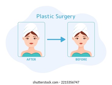 Plastic Surgery Flat Cartoon Hand Drawn Templates Illustration of Medical Surgical Operation on the Body or Face as Expected using Advanced Equipment