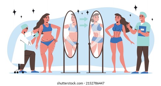 Plastic surgery flat concept with woman before and after hip liposuction vector illustration