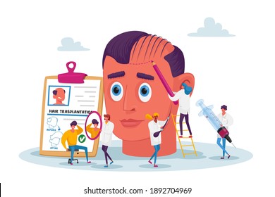 Plastic Surgery, Hair Receding, Loss Problem. Tiny Doctor Characters around Huge Male Head Making Hair Transplantation Procedure, Satisfied Patient Look in Mirror. Cartoon People Vector Illustration