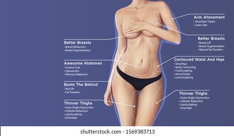 plastic surgery illustration with beautiful woman in black panties and list of surgeries