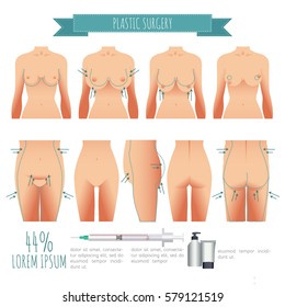 Plastic surgery illustrations. breast lift, lipofilling, abdominoplasty for your design