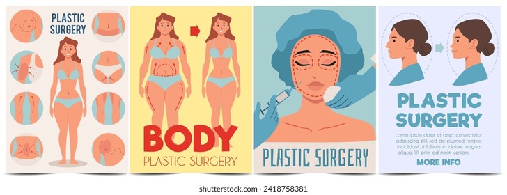 Plastic surgery infographics. Types of plastic surgery. Body and face plastic surgery, rhinoplasty, facial lift correction and reduction, liposuction, abdominoplasty vector posters set.