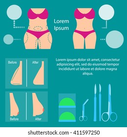 Plastic surgery. Liposuction and breast surgery
Change body shape. The result of plastic surgery. Vector illustration. Flat design