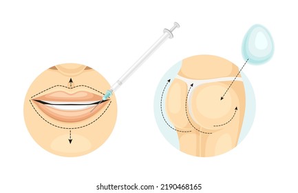 Plastic Surgery For Lips And Buttocks With Stipple Line And Syringe As Restoration And Reconstruction Of Human Face In Circle Vector Set