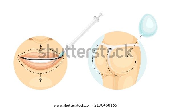 Plastic Surgery for Lips and Buttocks with Stipple\
Line and Syringe as Restoration and Reconstruction of Human Face in\
Circle Vector Set
