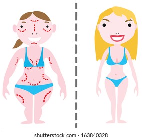 Plastic Surgery Makeover