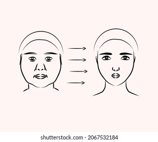 Cirugía plástica en la cara de una mujer. Silhouette V - línea de la cara. Ilustración vectorial.