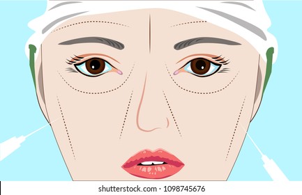 Plastic surgery processing