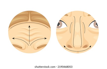 Plastic Surgery as Restoration and Reconstruction of Human Forehead and Nose in Circle Vector Set