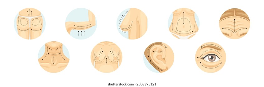 Cirurgia Plástica como Restauração e Reconstrução da Parte do Corpo Humano no Conjunto de Vetores Circulares