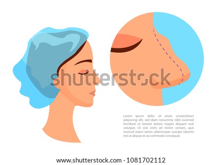 Plastic surgery - rhinoplasty. Reducing the nose. Girl with a big nose.