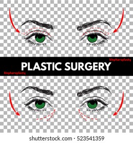 Plastic Surgery. Vector Illustration. 
