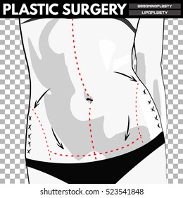 Plastic Surgery. Vector Illustration.