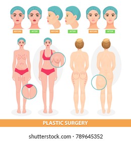 Plastic surgery vector patient woman before surgical operation facelifting or facial anti aging lift surgically or breast and face lined of surgeon illustration isolated on white background